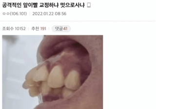 혐) 공격적인 앞이빨 교정하냐 멋으로사냐
